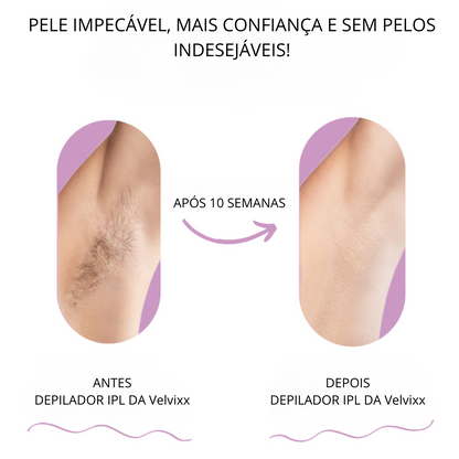 Velvixx Lumélia IPL, elimina os pêlos de forma definitiva, sem dor e em casa