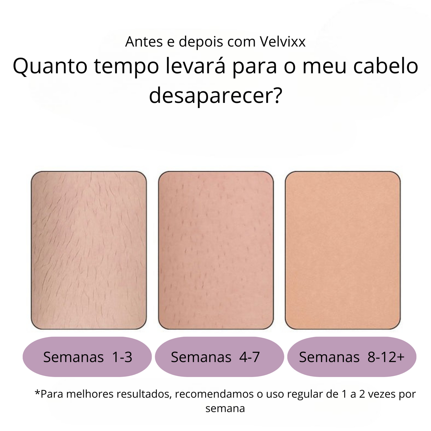 Velvixx Lumélia IPL, elimina os pêlos de forma definitiva, sem dor e em casa