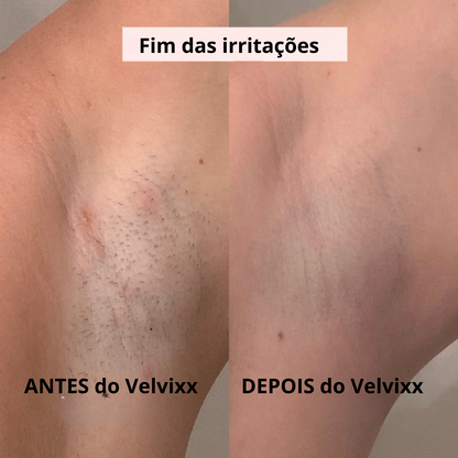 Velvixx Pele de Seda