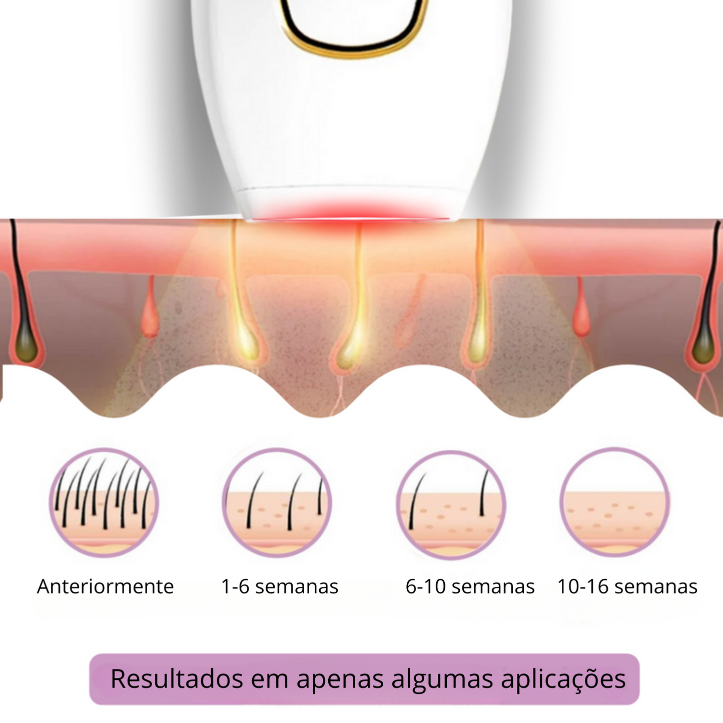 Velvixx Lumélia IPL, elimina os pêlos de forma definitiva, sem dor e em casa