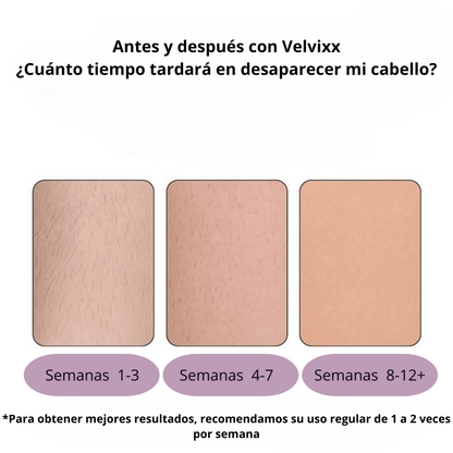 Velvixx Lumélia IPL, elimina el vello de forma definitiva, sin dolor y desde casa