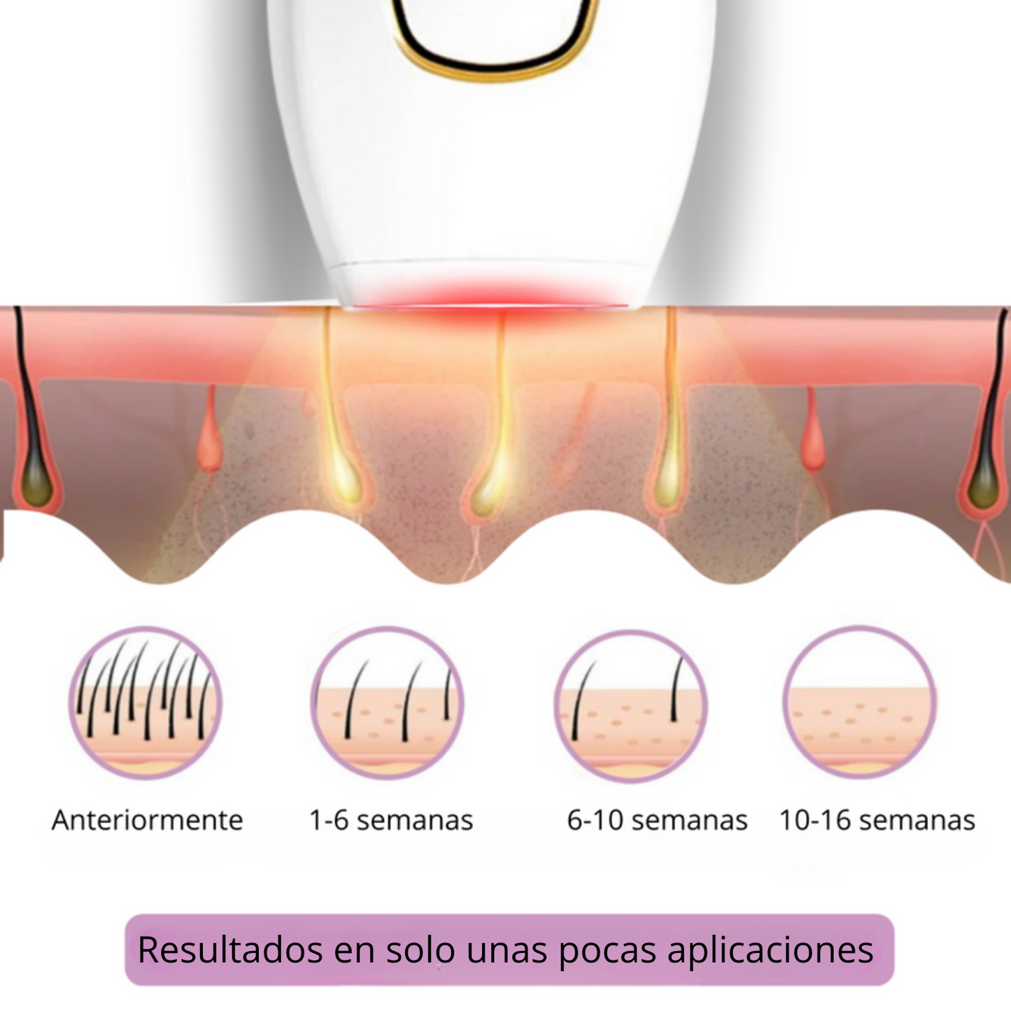 Velvixx Lumélia IPL, elimina el vello de forma definitiva, sin dolor y desde casa
