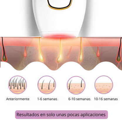 Velvixx Lumélia IPL, elimina el vello de forma definitiva, sin dolor y desde casa