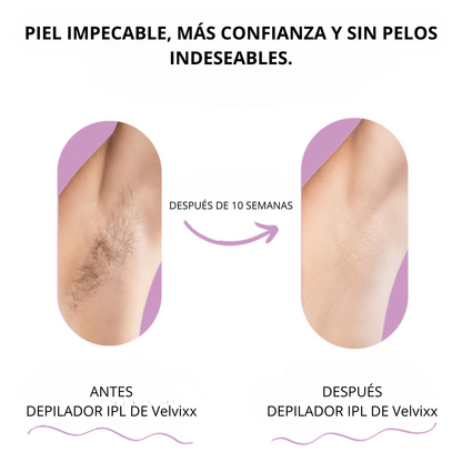 Velvixx Lumélia IPL, elimina el vello de forma definitiva, sin dolor y desde casa