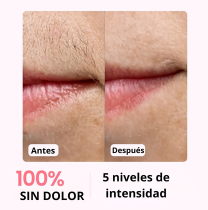Velvixx Lumélia IPL, elimina el vello de forma definitiva, sin dolor y desde casa