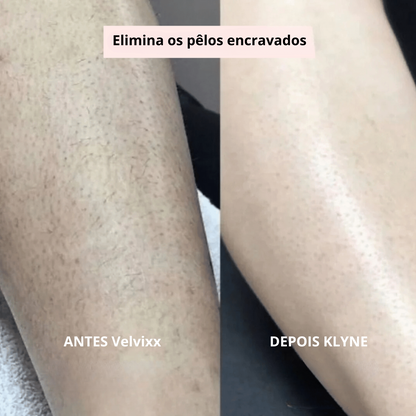 Velvixx Pele de Seda