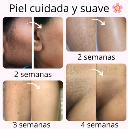 Velvixx Lumélia IPL, elimina el vello de forma definitiva, sin dolor y desde casa