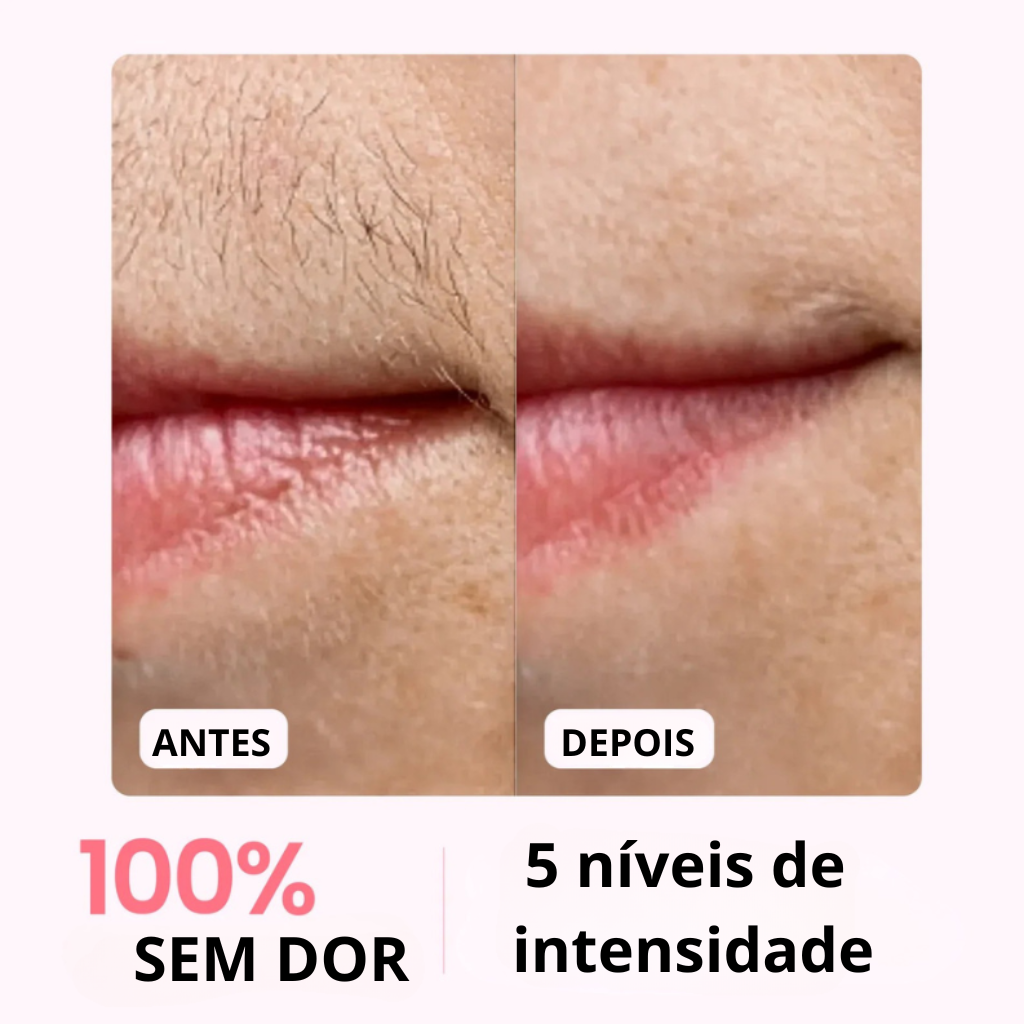 Velvixx Lumélia IPL, elimina os pêlos de forma definitiva, sem dor e em casa