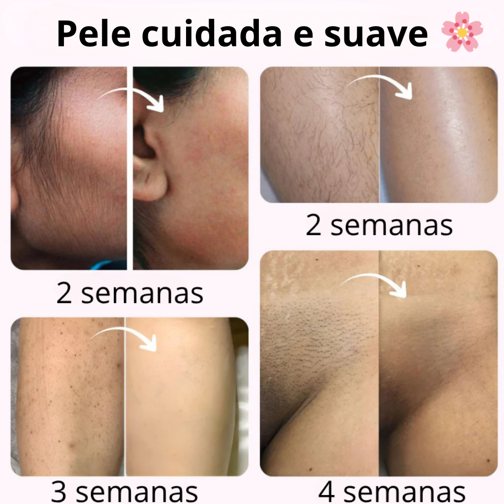 Velvixx Lumélia IPL, elimina os pêlos de forma definitiva, sem dor e em casa